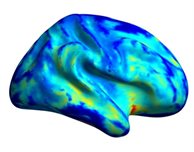 DMU brain scan study finds evidence that autism is a difference, and not a deficit