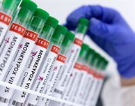 Important information about the Monkeypox virus