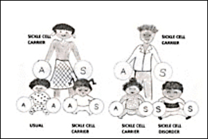 SickleCell-Image